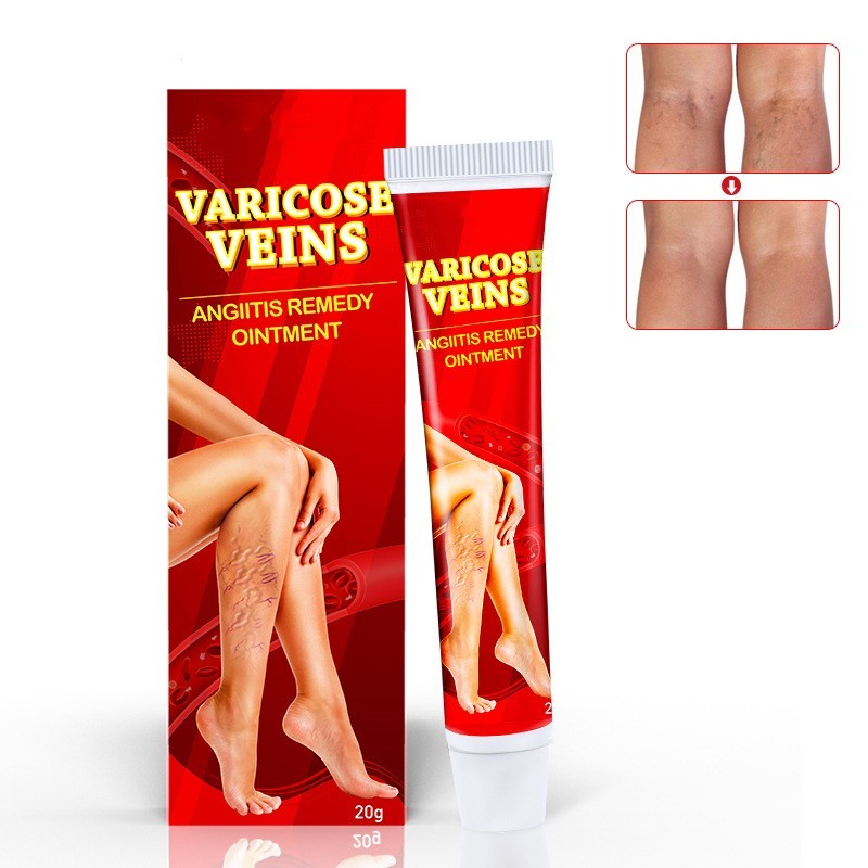 Pommade à la veine Shu Soft Ver Jambe Crème Tube vasculaire – Image 9